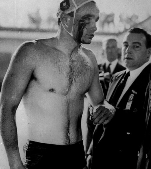 澳大利亚又出杰作 男子水球队赛中与对手互殴